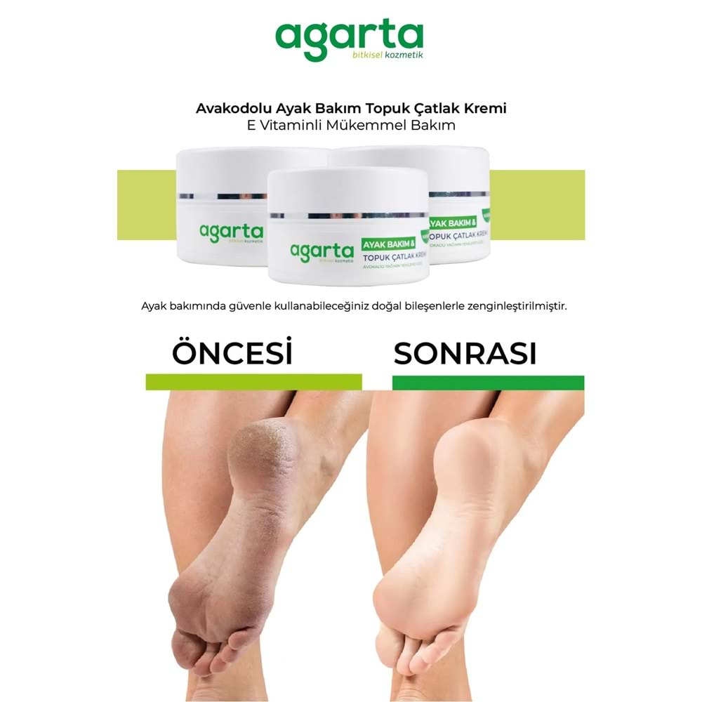 Agarta Ayak ve Topuk Çatlak Bakım Kremi 100ML (5 Li Set)